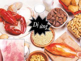 Cách nhận biết và phòng tránh dị ứng thức ăn